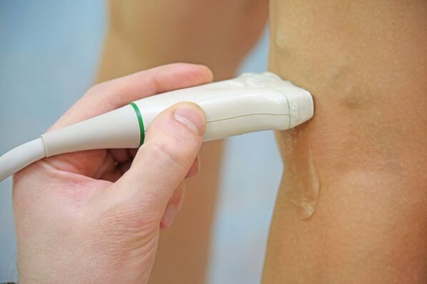 Veins ultrasound